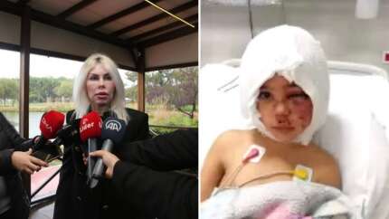 Pitbull saldırısına uğrayan Minik Asiye'den haber var: Yüz felci ameliyat ile geçecek!
