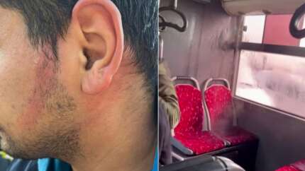 İETT otobüsünde bozuk klima dehşeti: Kaynar sular yolcunun üzerine döküldü!