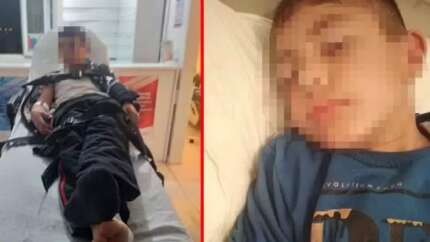 Kuduz tanısı konulan çocuktan kötü haber!