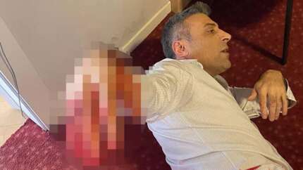 Yenilik Partisi lideri Öztürk Yılmaz'a bıçaklı saldırı