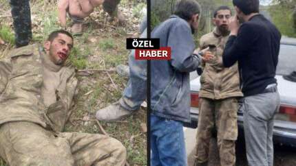 İşte Ermeni zulmü! Azerbaycan askerine böyle işkence yaptılar!