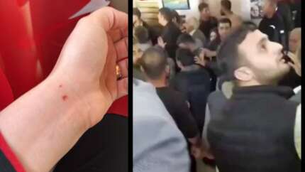 DEM Partililer AK Parti Belediye Başkanına saldırdı! "Oy kullanmamıza engel olmak istediler"