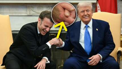 Trump'ın eline ne oldu? Gizemli morluk dikkat çekti! Macron ile tokalaşmasında ilginç detay...