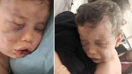 2 yaşındaki çocuğa vahşeti yaşattılar! Masum çocuk yoğun bakımda, anne ile sevgilisi gözaltında...