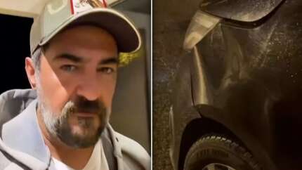 Ünlü oyuncu Celil Nalçakan trafik kazası geçirdi! Görüntüleri kendi paylaştı...