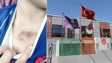 İBB suçluları mı koruyor? 3 yaşında çocuğa şiddet olayında gerçeklerin üzeri örtülüyor