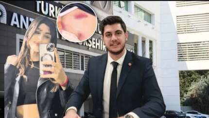 Antalya Büyükşehir Belediyesi'nde skandal iddia: Meclis üyesi Taylan Şanlı, genç kadına korku dolu anlar yaşattı! "İyi ki sen soyunurken video çekmişim..."