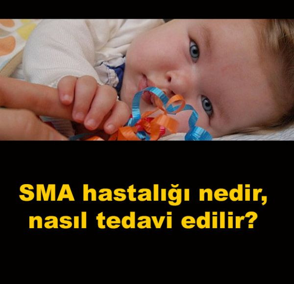 SMA_hastalAAA_nedir