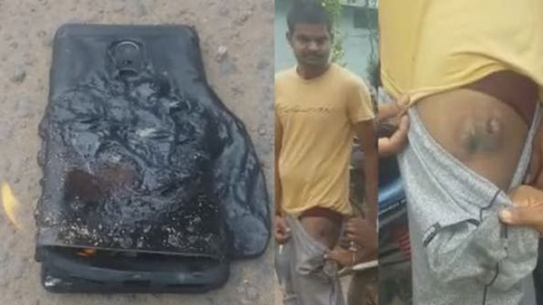 redmi-note-4-patlayarak-sahibini-sakat-birakti-1502703377