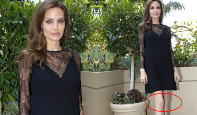 38 kiloya d&uuml;şen Angelina Jolie'yi g&ouml;renler dehşete kapılıyor!