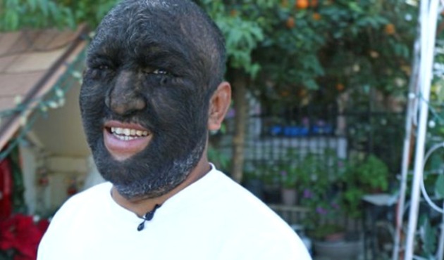 D&uuml;nyanın en kıllı adamı mutluluğu buldu!
