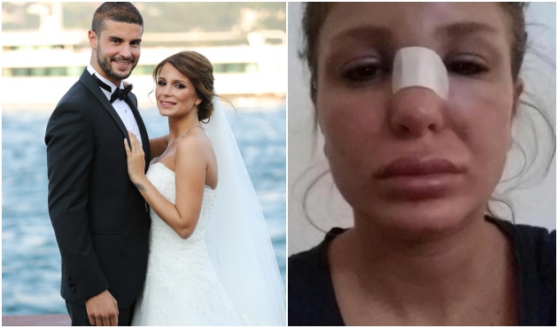 Berk Oktay'a korkun&ccedil; su&ccedil;lama: Kocam beni d&ouml;vd&uuml;!