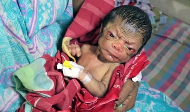 İşte ger&ccedil;ek Benjamin Button!