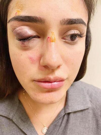 CEREN KAPLAKARSLAN