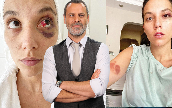 Ozan Güven sözünden geri döndü! Beklenmeyen hareket geldi