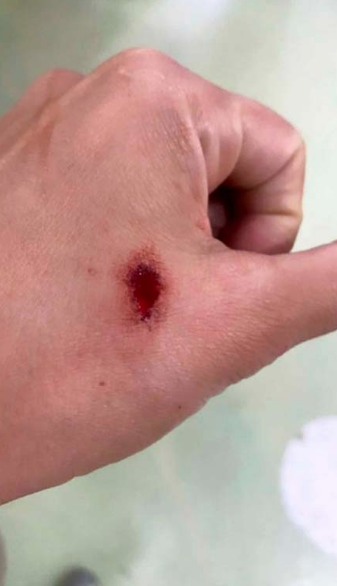 Eski voleybolcu Duygu Bal sokak k&ouml;peklerinin saldırısına uğradı! Apartmana sığındı