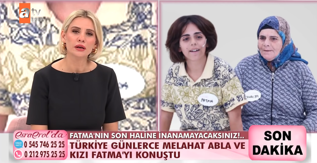 Esra Erol'da zihinsel engelli Fatma'nın son hali yürekleri dağladı! Saçlarını kazıttı