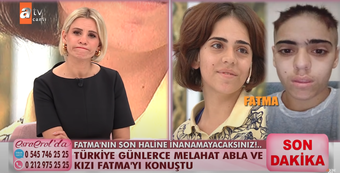 Esra Erol'da zihinsel engelli Fatma'nın son hali yürekleri dağladı! Saçlarını kazıttı