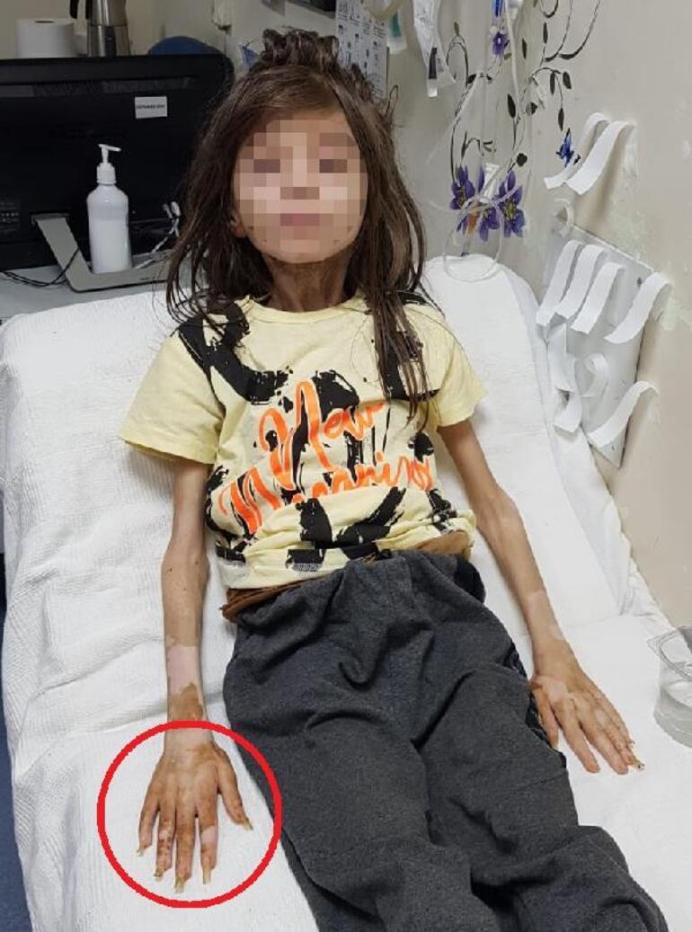 Yer: Bursa... 1 yıldır çöp dolu odada kilitli Kapı açıldı, ekipler şoke oldu