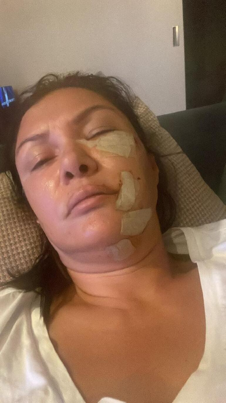 Sevda Demirel, Tuğba Altıntop'tan &ouml;z&uuml;r diledi