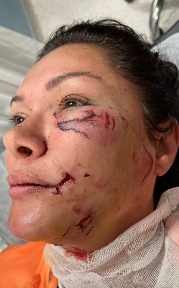 Sevda Demirel, Tuğba Altıntop'tan &ouml;z&uuml;r diledi